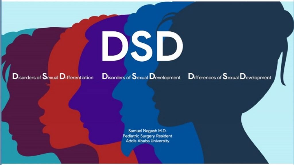 DSD