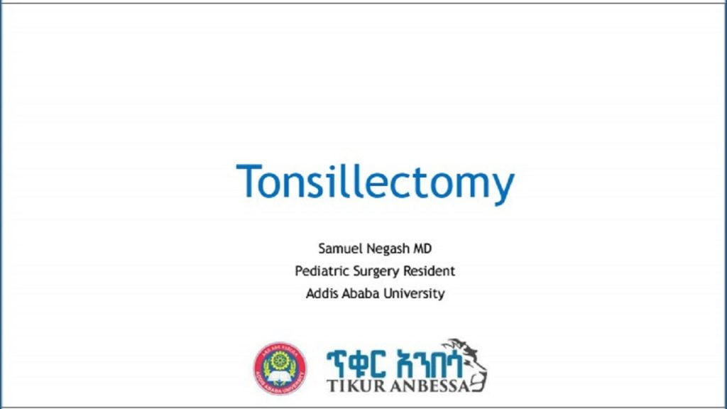 Tonsillectomy