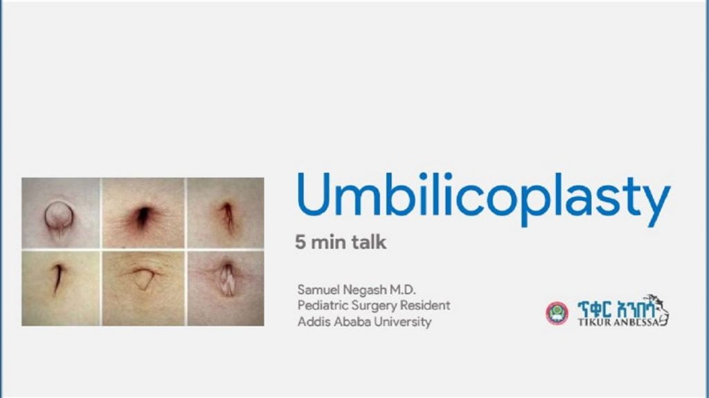 umbilicoplasty