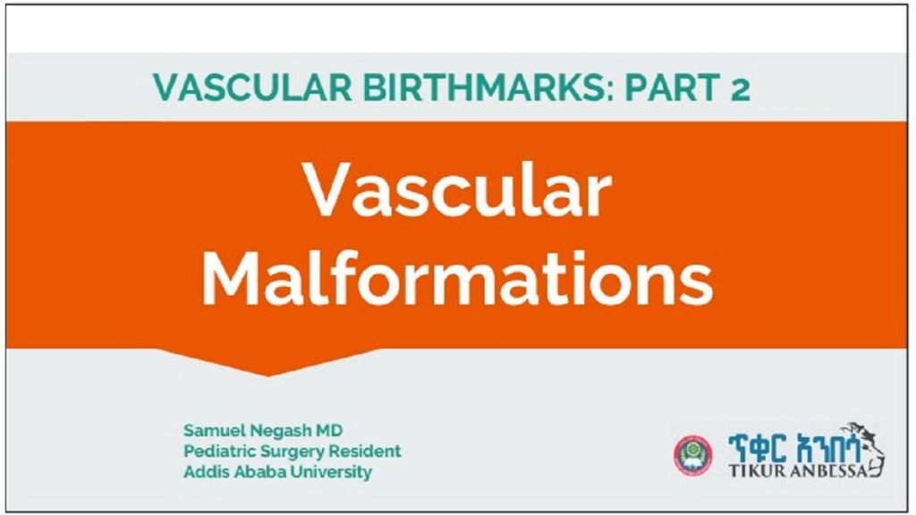 vascular malformation