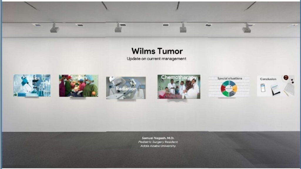 wilms tumor